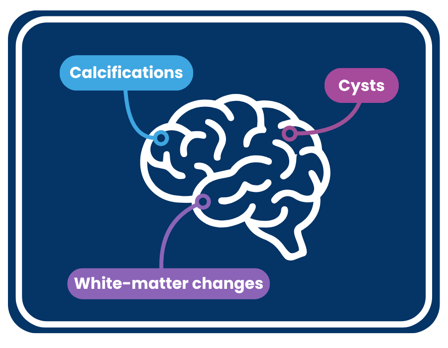 Brain Diagram Graphic